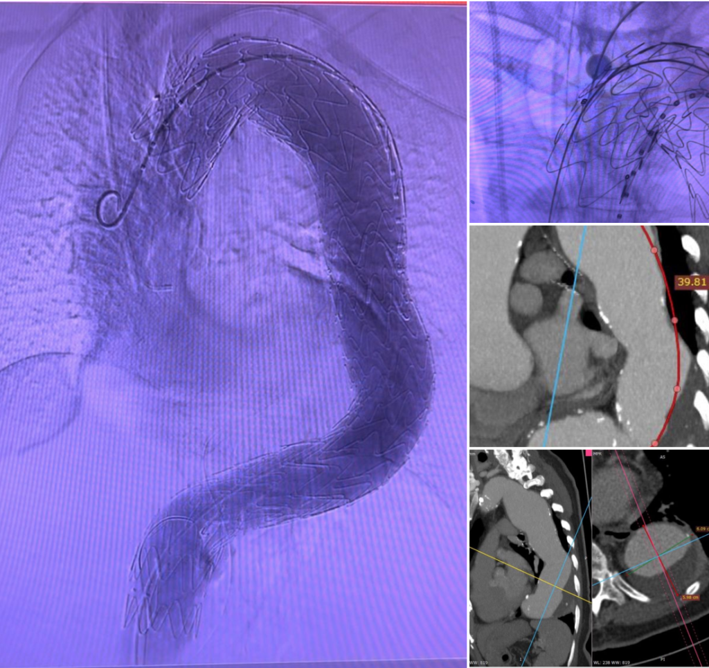 dr sumanto linkdien case study